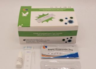 Ancona, il rapid test proposto dalla Innoliving adottato in Emilia Romagna kit coronavirus